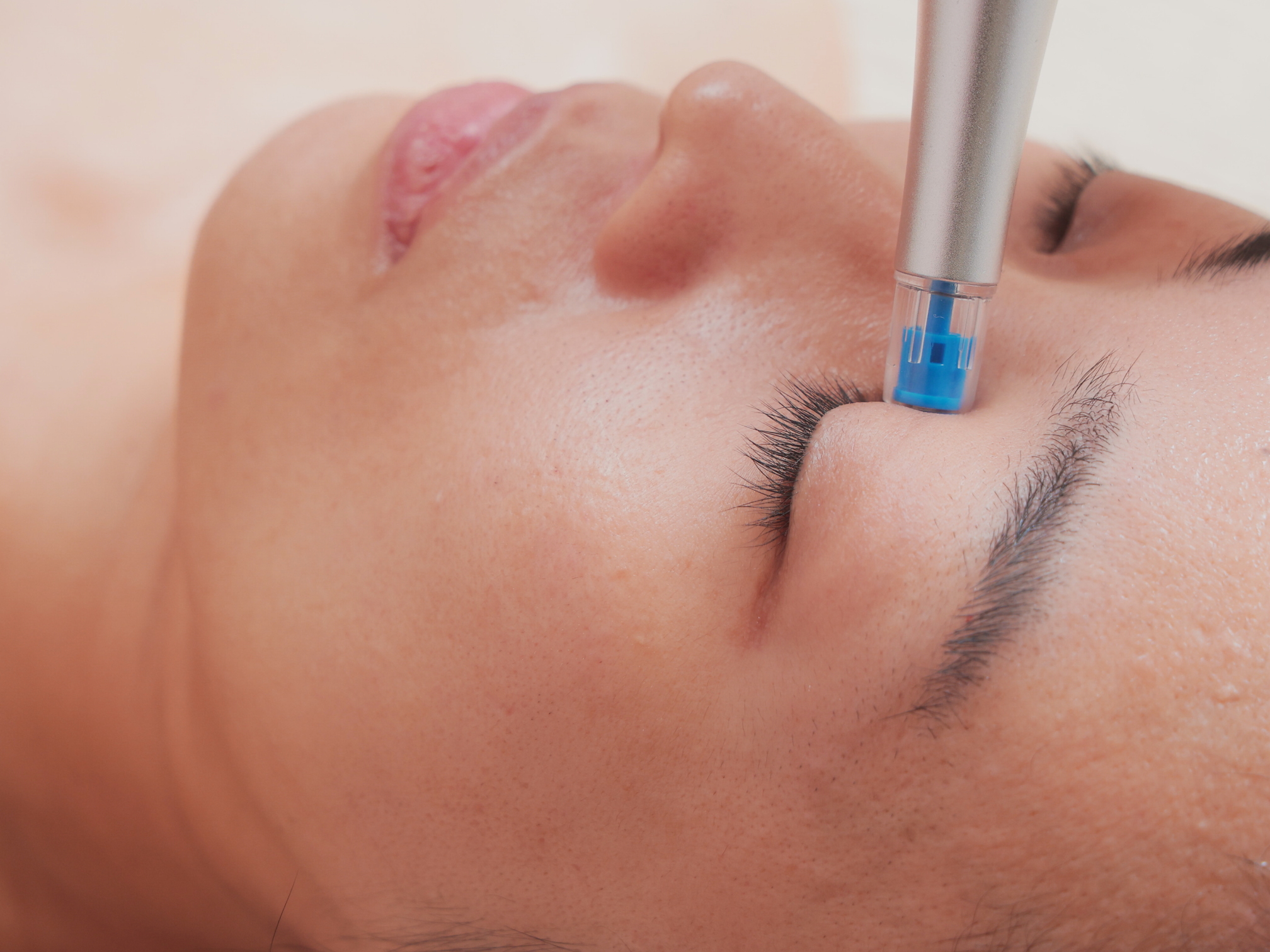 💡リゼネレート・ナノチップのここが凄い